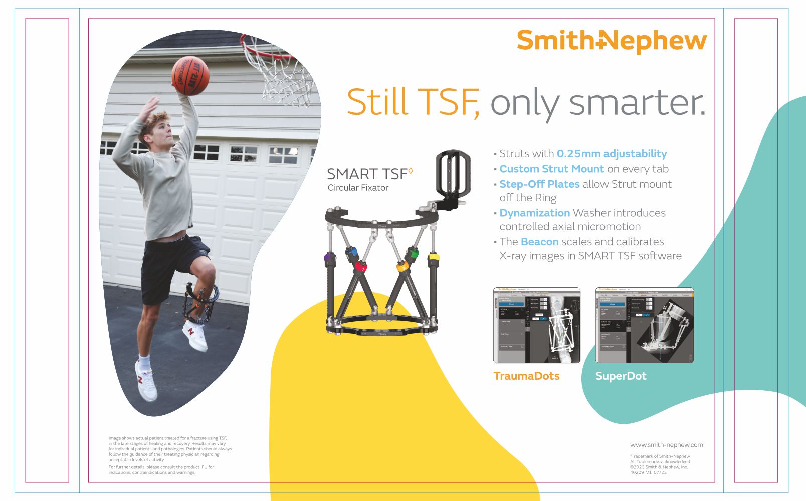 Smith+Nephew Smart TSF
